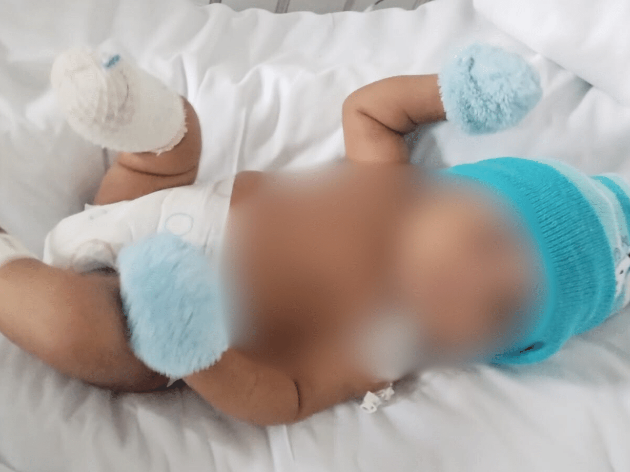 Bebê de 2 meses perde pé após complicações de bronquiolite e mãe denuncia erro médico Heitor teve o pé amputado após falha de acesso intravenoso (Foto: Cedido ao UOL)