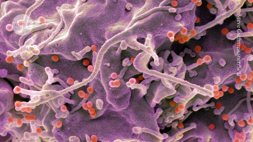 Partículas de HIV (pontos vermelhos) entram nas células usando proteínas que se ligam à membrana celular. (Foto: Steve Gschmeissner/Science Photo Library)