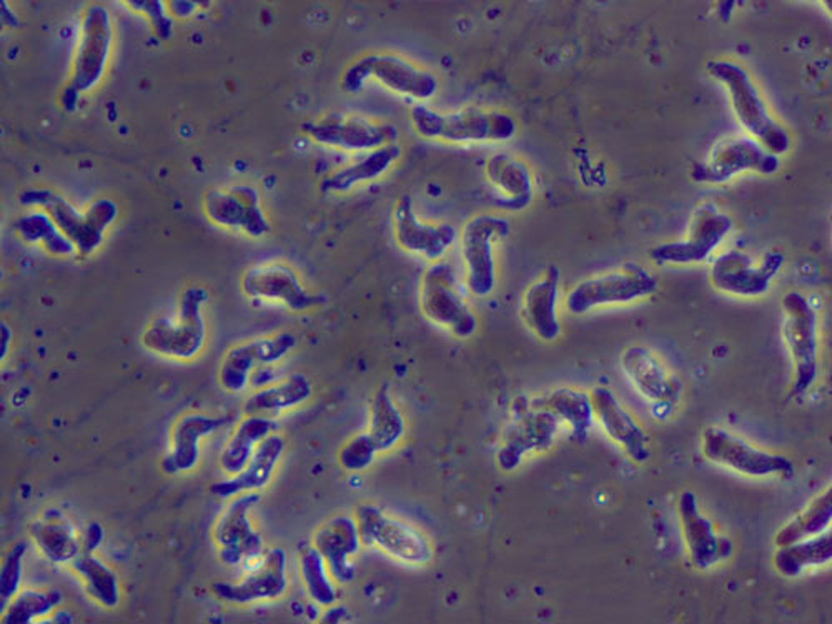 Paciente nos Estados Unidos morre após infecção por 'ameba comedora de cérebros' Ameba Naegleria fowleri, conhecida como 'comedora de cérebros' (Foto: Reprodução Centros de Controle e Prevenção de Doenças - CDC)